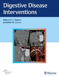 Cover Digestive Disease Interventions