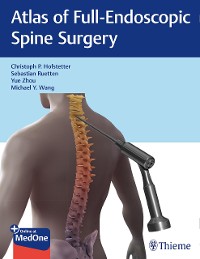 Cover Atlas of Full-Endoscopic Spine Surgery