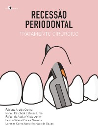 Cover Recessão Periodontal