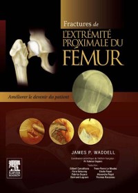 Cover Fractures de l''extrémité proximale du fémur