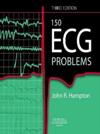 Cover 150 ECG Problems