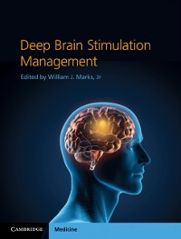 Cover Deep Brain Stimulation Management