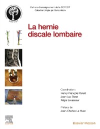 Cover La hernie discale lombaire