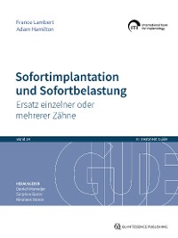 Cover Sofortimplantation und Sofortbelastung