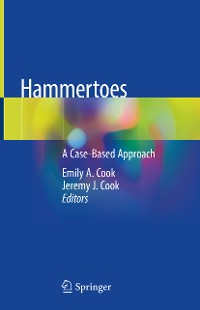 Cover Hammertoes