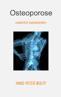 Cover Osteoporose natürlich bekämpfen