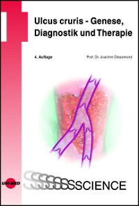 Cover Ulcus cruris - Genese, Diagnostik und Therapie