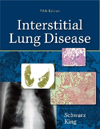 Cover Interstitial Lung Disease