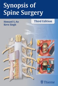 Cover Synopsis of Spine Surgery