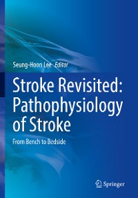 Cover Stroke Revisited: Pathophysiology of Stroke