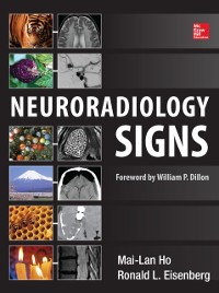Cover Neuroradiology Signs