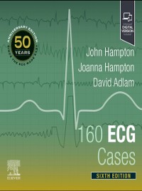 Cover 160 ECG Cases