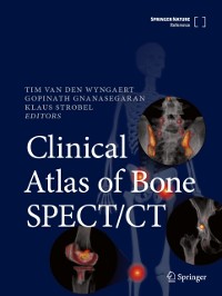 Cover Clinical Atlas of Bone SPECT/CT