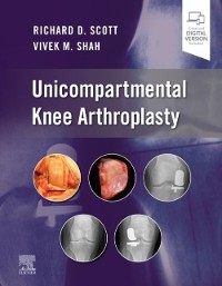 Cover Unicompartmental Knee Arthroplasty