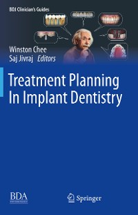 Cover Treatment Planning In Implant Dentistry