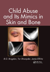 Cover Child Abuse and its Mimics in Skin and Bone