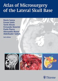 Cover Atlas of Microsurgery of the Lateral Skull Base