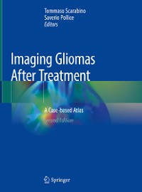 Cover Imaging Gliomas After Treatment