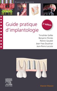Cover Guide pratique d''implantologie