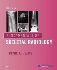 Cover Fundamentals of Skeletal Radiology E-Book