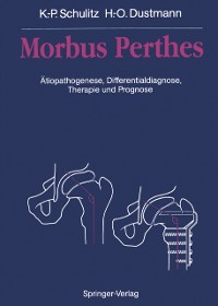 Cover Morbus Perthes