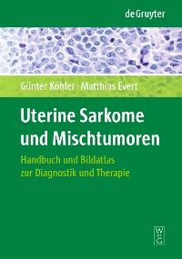 Cover Uterine Sarkome und Mischtumoren