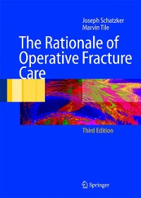 Cover The Rationale of Operative Fracture Care