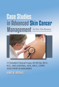 Cover Case Studies in Advanced Skin Cancer Management