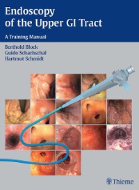 Cover Endoscopy of the Upper GI Tract