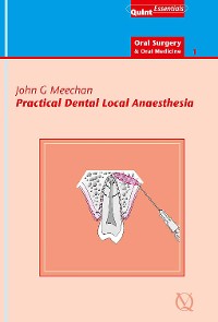 Cover Practical Dental Local Anaesthesia