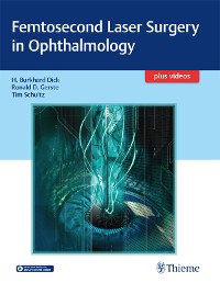 Cover Femtosecond Laser Surgery in Ophthalmology