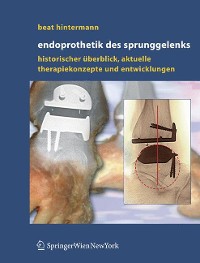 Cover Endoprothetik des Sprunggelenks