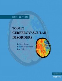 Cover Toole's Cerebrovascular Disorders