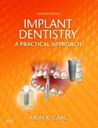 Cover Implant Dentistry - E-Book