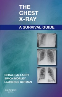 Cover Chest X-Ray: A Survival Guide