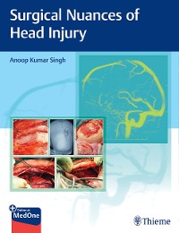 Cover Surgical Nuances of Head Injury