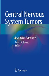 Cover Central Nervous System Tumors