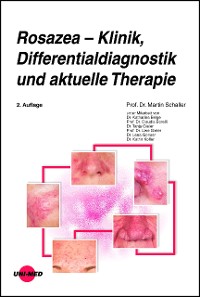 Cover Rosazea – Klinik, Differentialdiagnostik und aktuelle Therapie