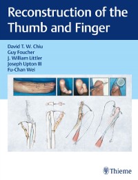 Cover Reconstruction of the Thumb and Finger