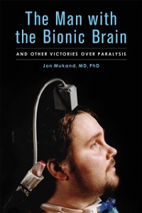 Cover The Man with the Bionic Brain