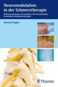 Cover Neuromodulation in der Schmerztherapie