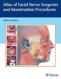 Cover Atlas of Facial Nerve Surgeries and Reanimation Procedures