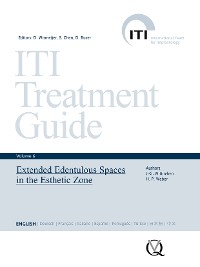 Cover Extended Edentulous Spaces in the Esthetic Zone