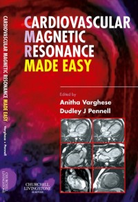 Cover Cardiovascular Magnetic Resonance Made Easy
