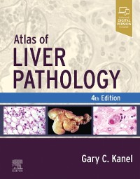 Cover Atlas of Liver Pathology - E-Book