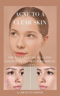 Cover Acne to a Clear Skin: Saying Goodbye to all Skin Blemishes in 7 Days
