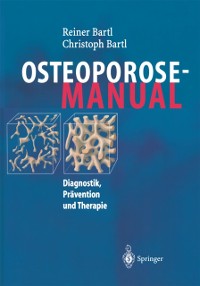 Cover Osteoporose-Manual