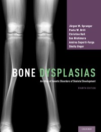 Cover Bone Dysplasias