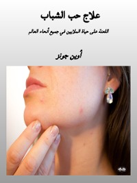 Cover علاج حب الشباب