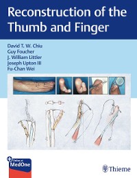 Cover Reconstruction of the Thumb and Finger